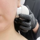 가양네거리 교통섬 | 대구 리턴리프팅 후기, 효과, 멍, 붓기 ; 유아이 에스테틱에서 피부관리