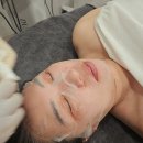 대구각산역 동호지구 기미, 잡티 피부관리 멜라소닉 건하뷰티 재방문 후기