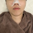 대구 달서구 죽전동 피부관리 레브제이 에스테틱 하이푸리프팅 관리 솔직후기