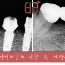 연세바른치과 이미지