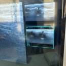 센텀서울정형외과의원 | 초등학생·아기 인대 파열 주의! 손·발목 접질림 Q&amp;A + 김해 율하 서울정형외과 후기