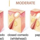 평화동-02 이미지