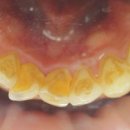 바이오크리닝 이미지