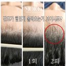 아벨리아카데미 | 울산탈모케어 후기