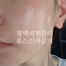 유스킨케어 - 북구 | 평택피부관리 :: <유스킨라운지> 발란스테라피로 피부 케어 + 두통, 두피까지 해결한 후기