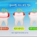 단성부식