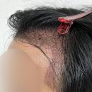 모원성형외과의원 이미지