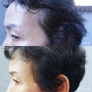 후거스닷컴(HOOGUS) | 2달째 새치케어 중 새치탈모샴푸 대세 려 블랙샴푸 리얼후기 염색샴푸 고민한다면 주목!