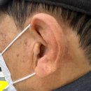 일등 보청기 이미지