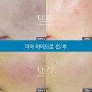 더마올가스킨 네이버블로그