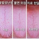 원자한의원 이미지