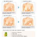 코젤 가슴성형후, 뭉치지 않는 가슴마사지 방법 공개!! - By 성형외과피부관리사 이미지