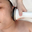 젠메디칼 | 구월동 에스테틱 엘레나이젠 얼굴 작아지기 시작한 노바리프팅 4회차 후기