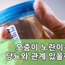 오줌이 노란이유 당뇨와 관계 있을까 이미지