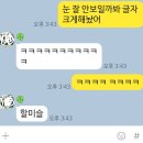 스마일라텍스 | ▶스마일라식 후기-!