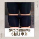 상상의원 | 부산 다이어트 의원 허벅지 지방분해주사 상상보다 효과 좋은 5회차 후기