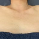 라라에스떼 | 부민동 문제성피부관리 전문 라라에스떼 골드테라피 후기