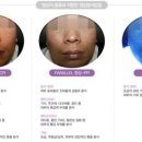 애플피부샵 이미지