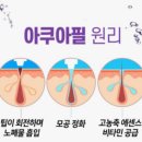 환절기 통증없는 피부과 시술 및 홈디바이스 추천(메디큐브 하이포커스샷)