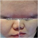피부보약! 미백! 모공! 탄력앰플! 파이진글로벌 파이온텍 비타펩타이드앰플 사용후기