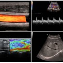 으뜸헬스케어 이미지