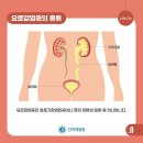 소변 참으면 병 된다? 급성신우신염 이미지