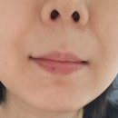 PH 메디칼 | 고보습 안티에이징 보스러브 시카엑소좀 아스타잔틴 약산성 항산화크림 사용 후기