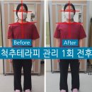 바른체형척추관리 이미지