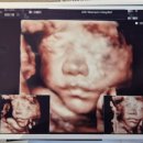 신우약국 | [임신25주] 아인병원 정밀초음파 재검, 입체초음파, 임당검사 후기, 랄츠임신축하선물