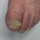 레푸스 감삼점&에이레네 이미지