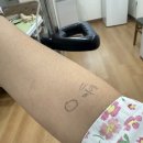 유앤미외과의원 | 맘모톰수술 후기 주의사항 관리 유방 결절 섬유선종