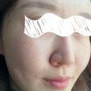 가경파크약국 | 청주 네일바이미뷰티에서 기미 싹 지우고 왔어요! 멜라리티 리얼 후기