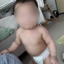 모세로 | 감기인 줄 알았는데 다음날 모세기관지염 진단, 8개월 아기 후기