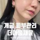 더프로젝트 | 개금 피부관리 더아움채윤 뷰티프로젝트 웨딩케어 내돈내산 솔직후기