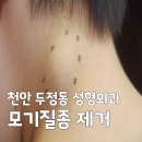 몽벨리아성형외과의원 | 천안 두정동 성형외과 모기질종 제거 후기: 피부 속 딱딱한 혹, 원인과 수술 비용 총정리