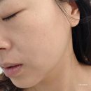 나미살롱 - 강남구 | 30대 피부관리 추천 나미살롱 에스테틱 탱쎄라 리프팅 관리 후기