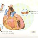 One Hundred <백세 시대의 주인공> - 1편 : 고혈압 이미지