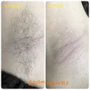 순수아미 이미지