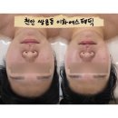 이화공원 화장실 | 천안 윤곽관리 쌍용동 이화에스테틱 천안얼굴비대칭 천안윤곽관리