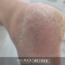 대신 | 광장동 패디플래닝, 발각질 크림 대신 케어 후기