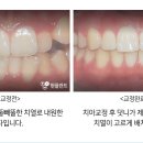 서울현플란트 치과의원 이미지