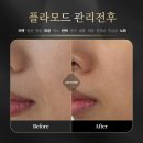 피플라
