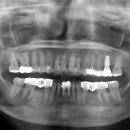 치과기공소 여름 이미지