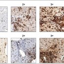 ﻿"몸에 좋다고 약 마구 먹었다간 간 손상"…발병기전 첫 규명 이미지