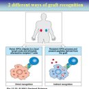 면역 : 이식거부 이미지
