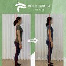 전방프라자 | 분당 정자동 필라테스에서 알아보는 골반전방경사 개선법!