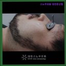 스노우의원대전둔산 이미지