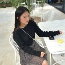 마르헤어페이스 | [성형] 풀페이스 지방이식 1차 _내돈내산, 자세한 후기