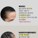 마음에점을찍다두피SMP 이미지