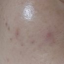 신피부과의원 이미지